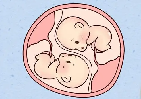 试管婴儿单卵双胞胎是什么原因？