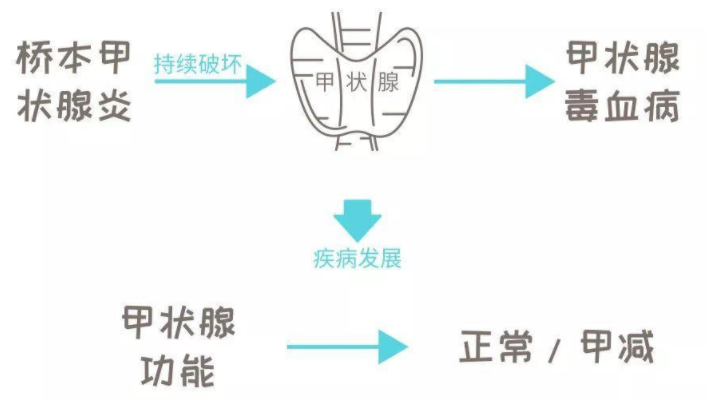 桥本甲状腺炎可以做试管婴儿吗？